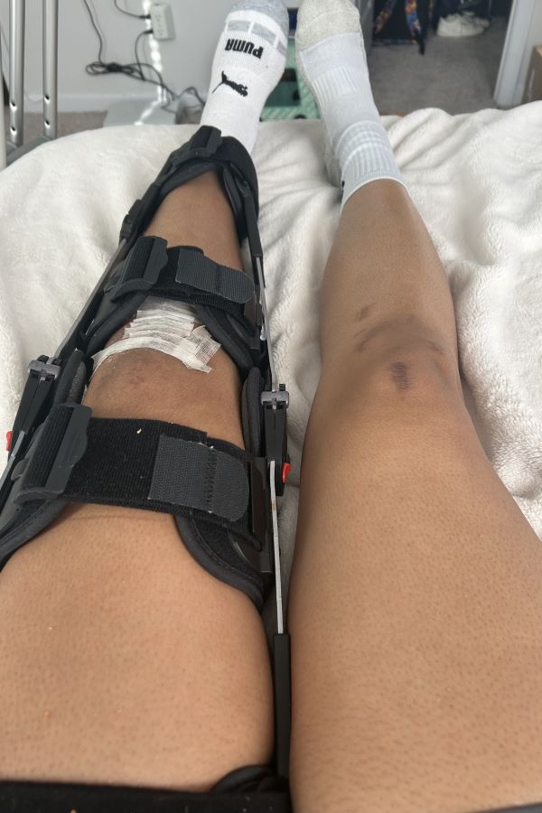 Knee NC